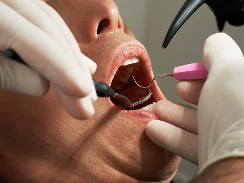 a person's mouth with teeth